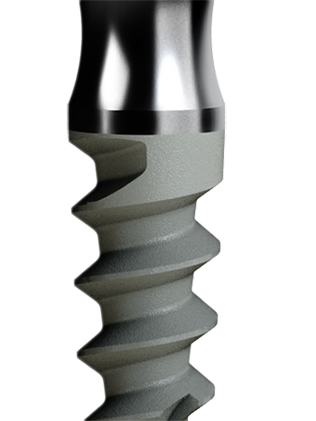 OPI Implant 3D Model