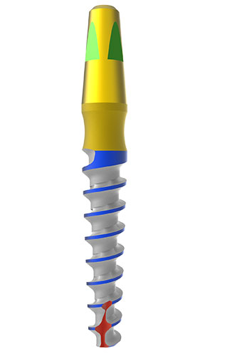 OPI Implant Full Body - 3D Model